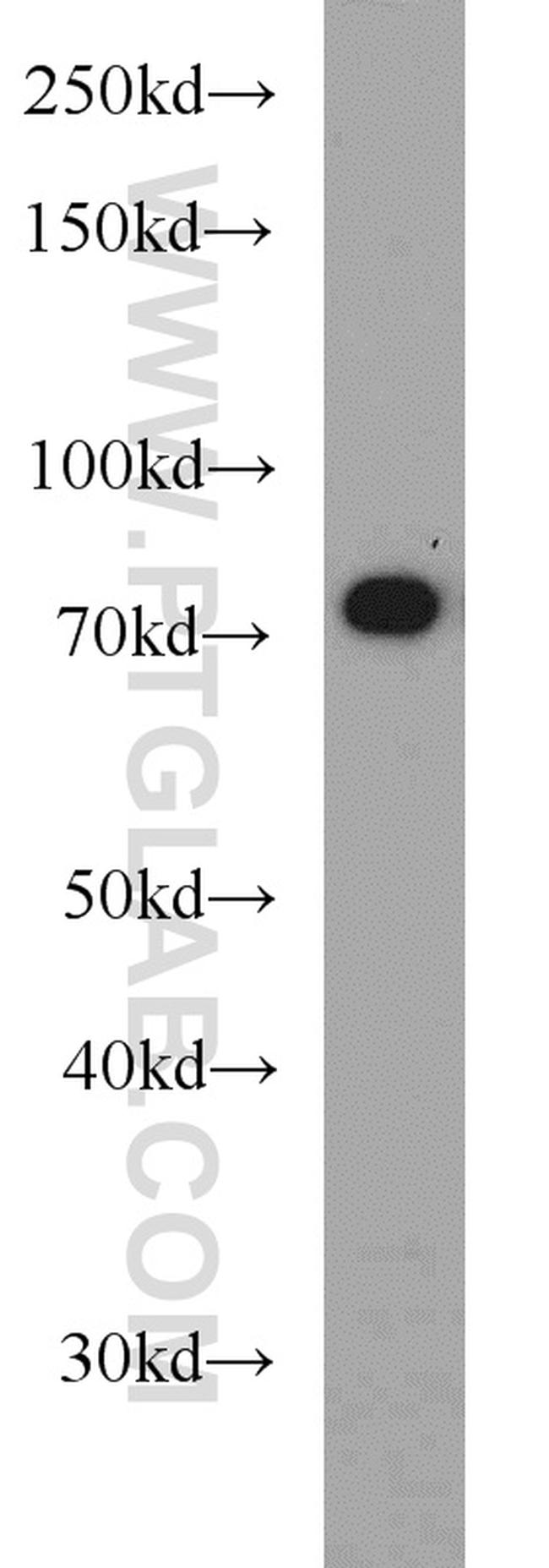 SYVN1 Antibody in Western Blot (WB)