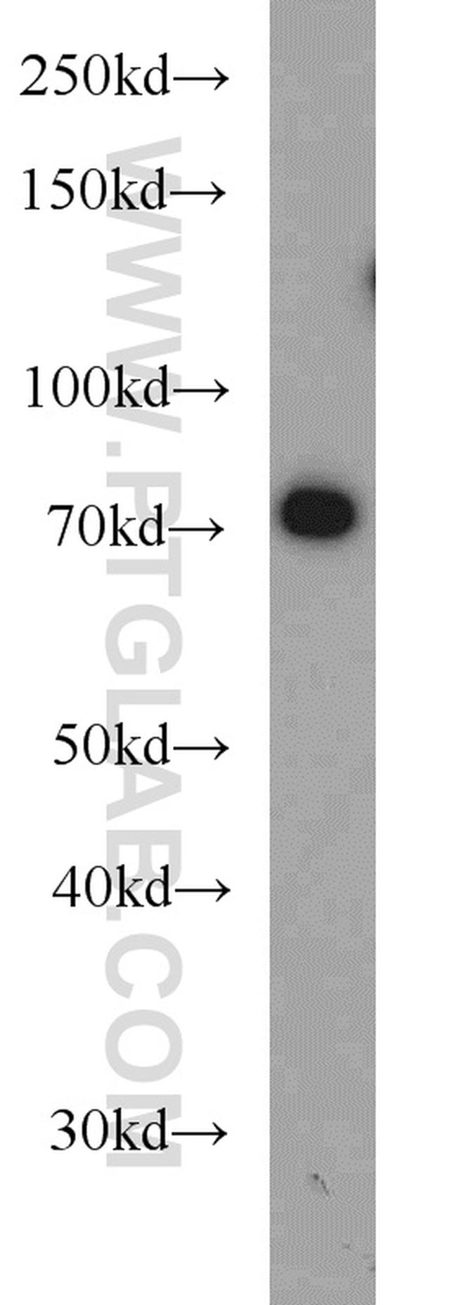 SYVN1 Antibody in Western Blot (WB)