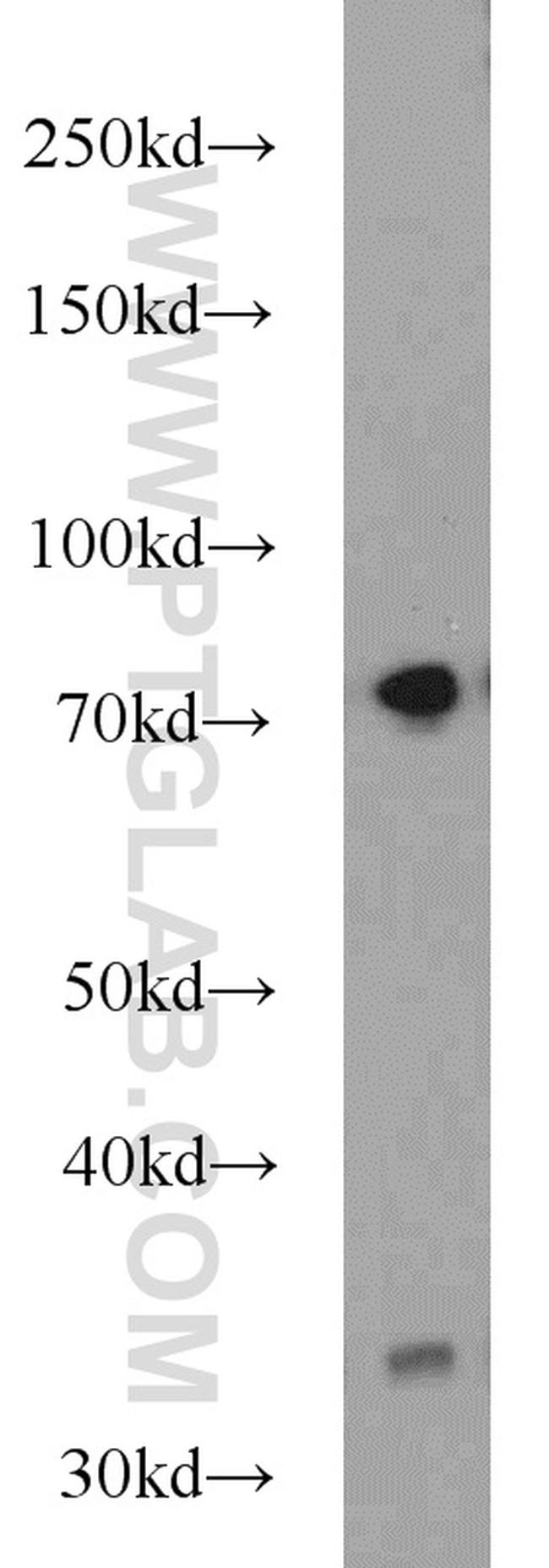 SYVN1 Antibody in Western Blot (WB)