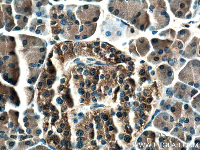 SPINK1 Antibody in Immunohistochemistry (Paraffin) (IHC (P))