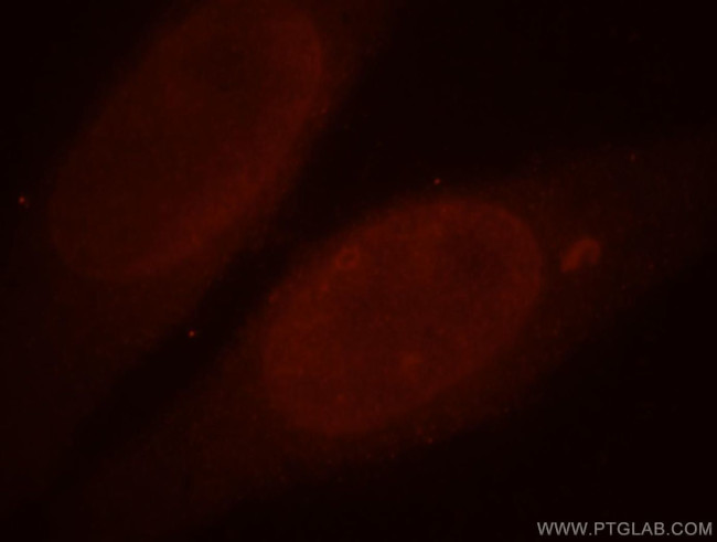 ALLC Antibody in Immunocytochemistry (ICC/IF)