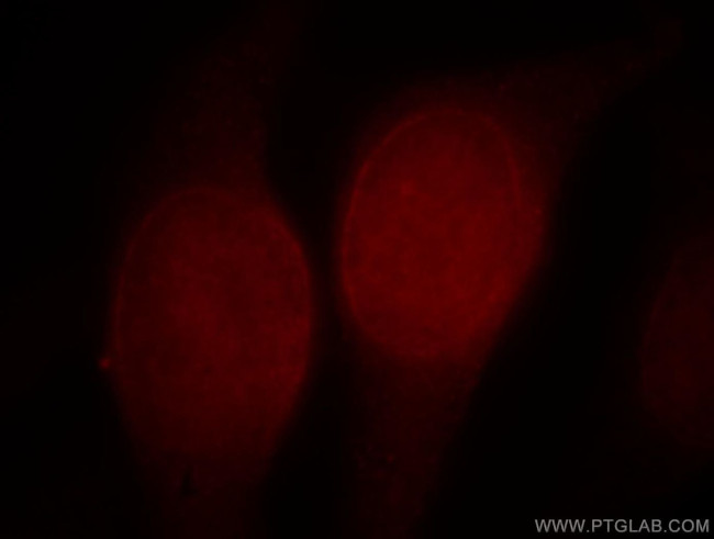 ALLC Antibody in Immunocytochemistry (ICC/IF)