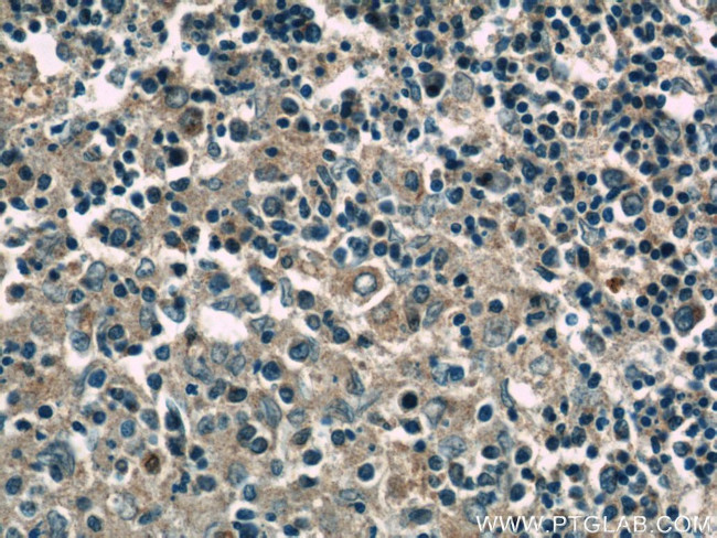 ALLC Antibody in Immunohistochemistry (Paraffin) (IHC (P))