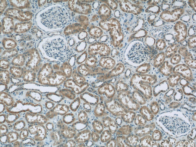 ALLC Antibody in Immunohistochemistry (Paraffin) (IHC (P))