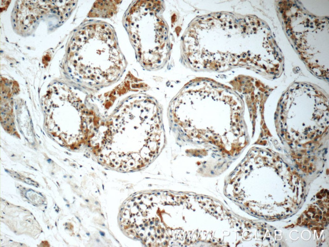 ALLC Antibody in Immunohistochemistry (Paraffin) (IHC (P))