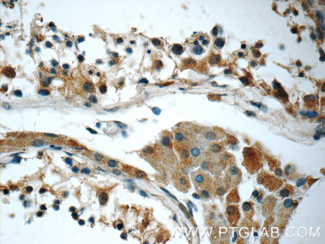 ALLC Antibody in Immunohistochemistry (Paraffin) (IHC (P))