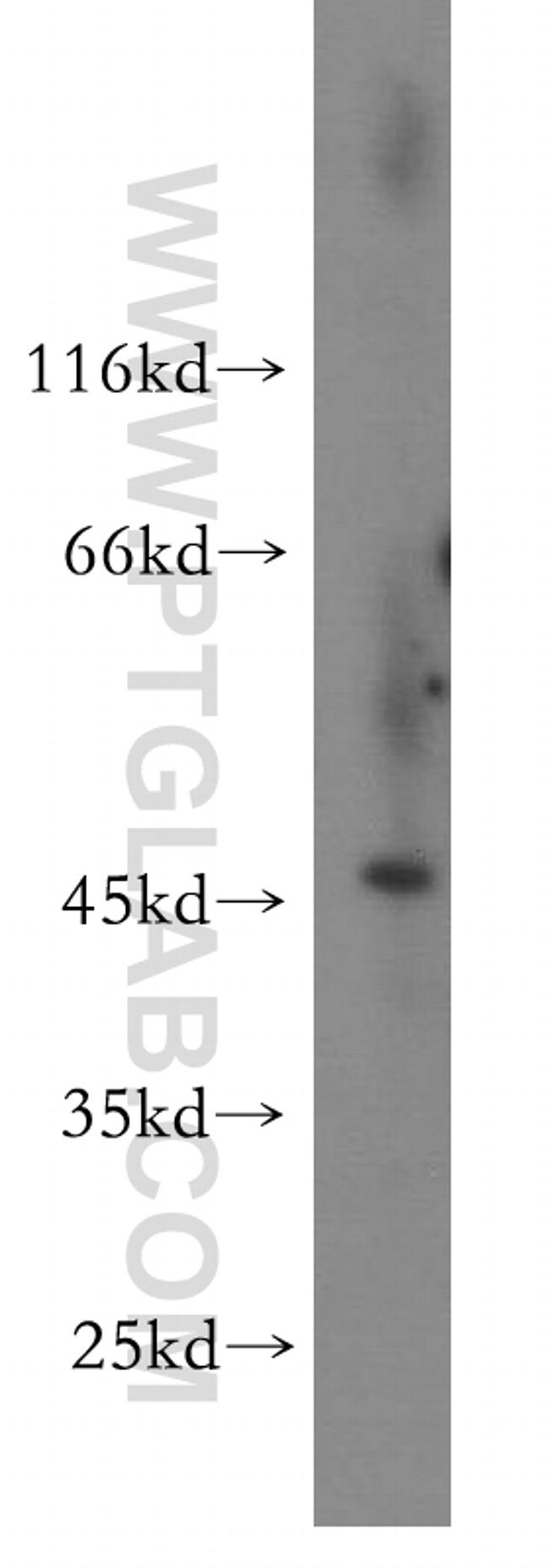 ALLC Antibody in Western Blot (WB)