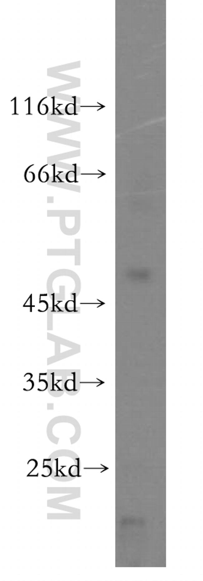 ALLC Antibody in Western Blot (WB)