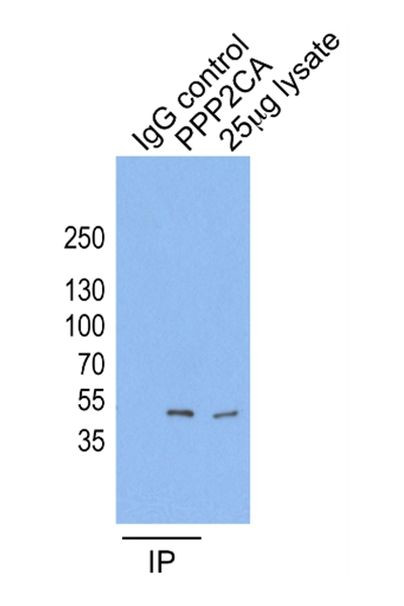 PPP2CA Antibody in Immunoprecipitation (IP)