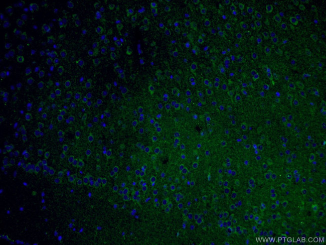 TREM2 Antibody in Immunohistochemistry (PFA fixed) (IHC (PFA))