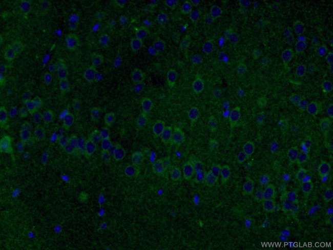 TREM2 Antibody in Immunohistochemistry (PFA fixed) (IHC (PFA))