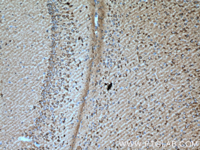 TREM2 Antibody in Immunohistochemistry (Paraffin) (IHC (P))