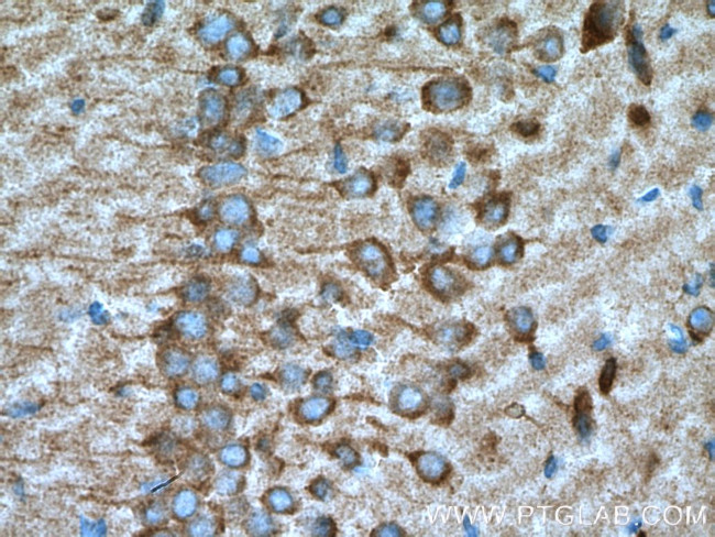 TREM2 Antibody in Immunohistochemistry (Paraffin) (IHC (P))