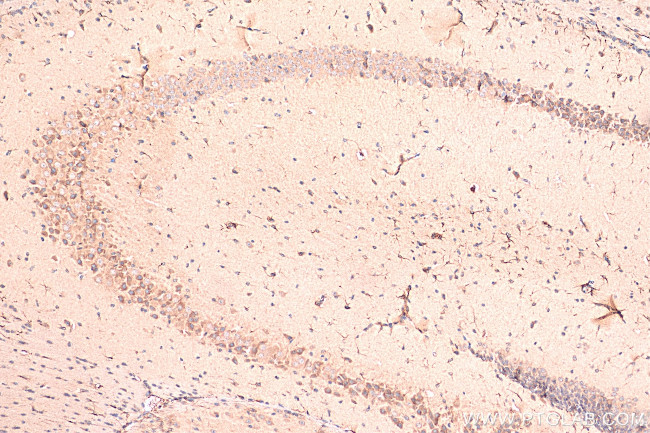 TREM2 Antibody in Immunohistochemistry (Paraffin) (IHC (P))