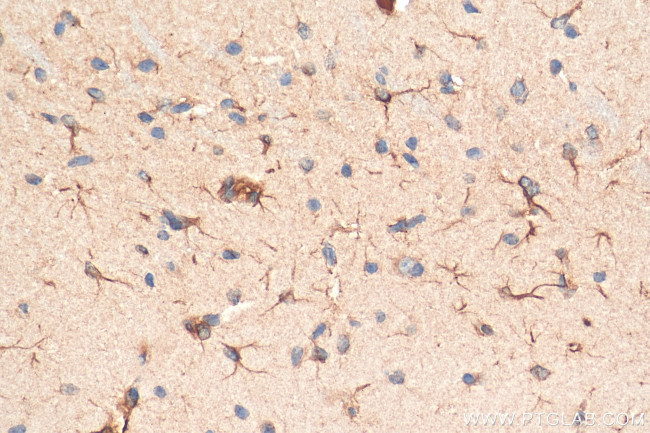 TREM2 Antibody in Immunohistochemistry (Paraffin) (IHC (P))