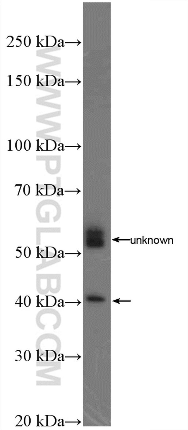 TREM2 Antibody in Western Blot (WB)