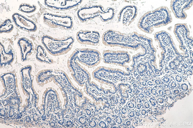 EVL Antibody in Immunohistochemistry (Paraffin) (IHC (P))