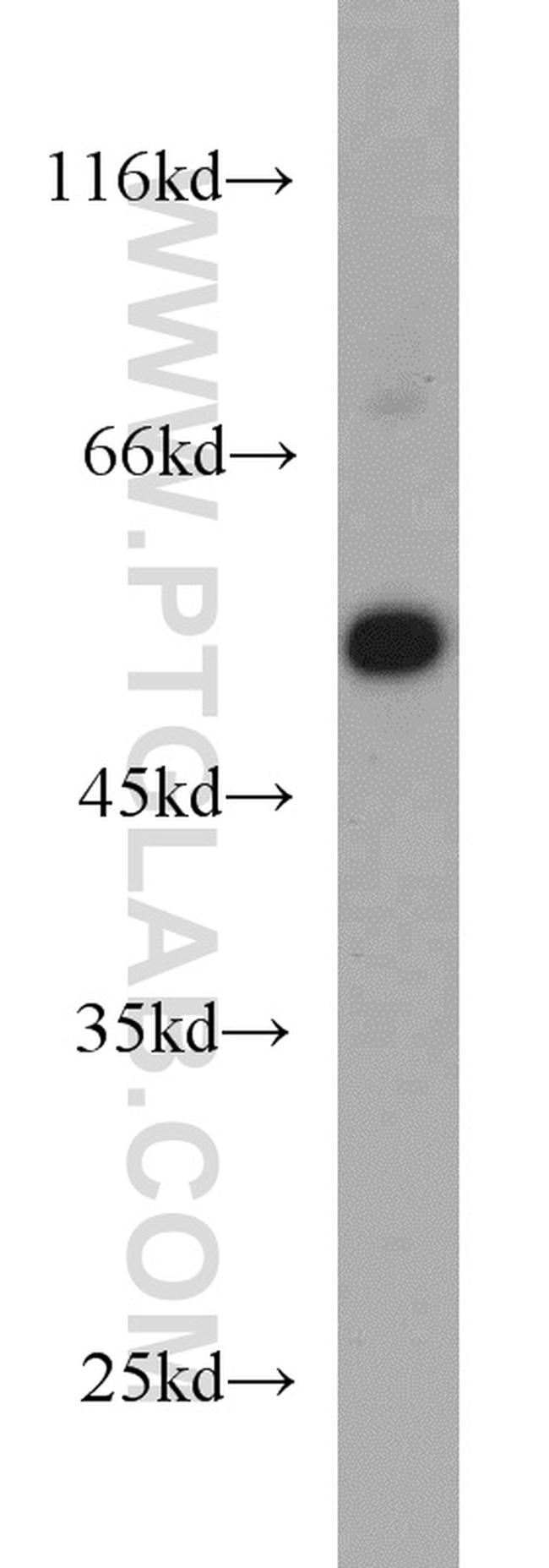 EVL Antibody in Western Blot (WB)