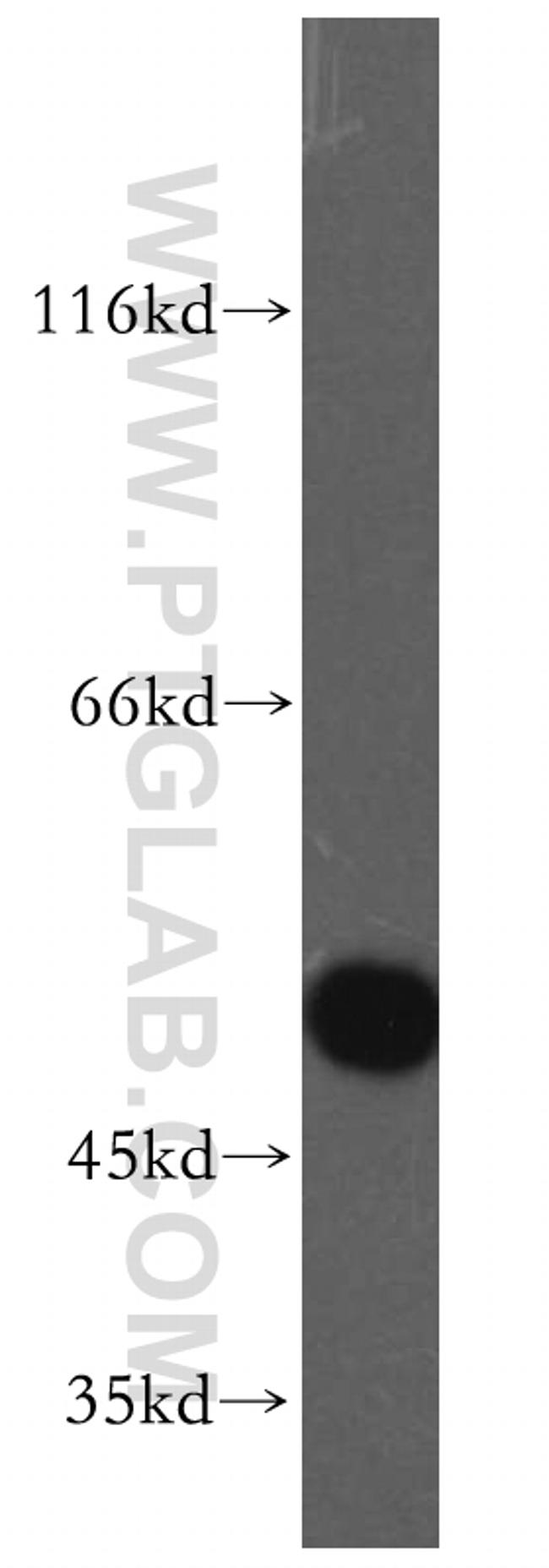 EVL Antibody in Western Blot (WB)