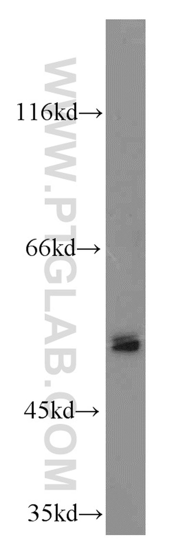 EVL Antibody in Western Blot (WB)