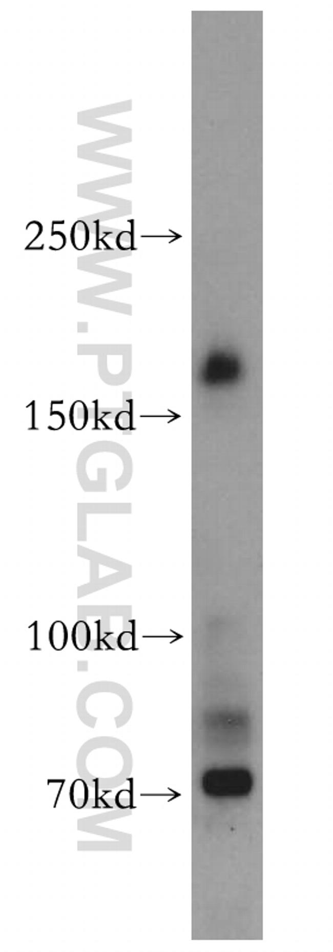 MTMR4 Antibody in Western Blot (WB)