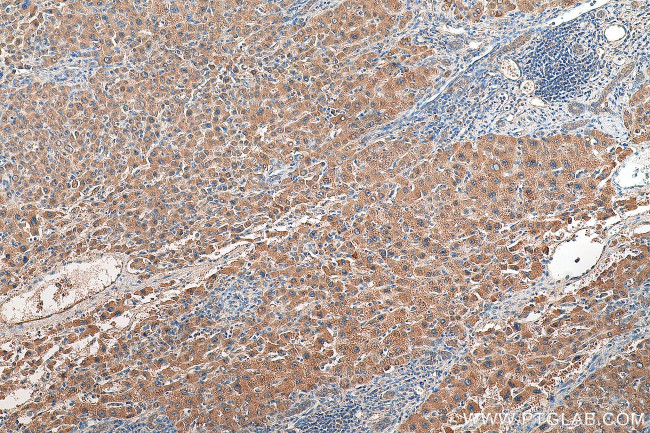 GPX7 Antibody in Immunohistochemistry (Paraffin) (IHC (P))