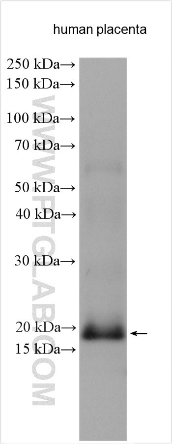 GPX7 Antibody in Western Blot (WB)