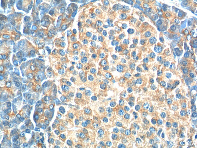 USP46 Antibody in Immunohistochemistry (Paraffin) (IHC (P))