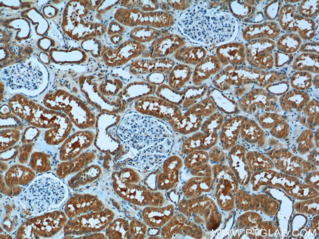 USP46 Antibody in Immunohistochemistry (Paraffin) (IHC (P))