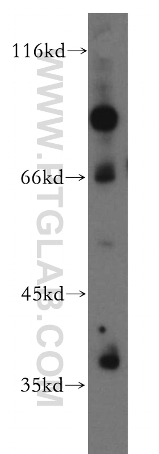 USP46 Antibody in Western Blot (WB)