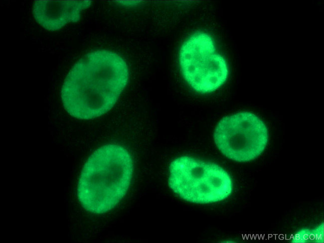 SNRPB2 Antibody in Immunocytochemistry (ICC/IF)