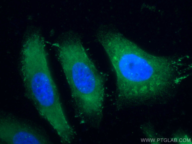 Choline kinase alpha Antibody in Immunocytochemistry (ICC/IF)