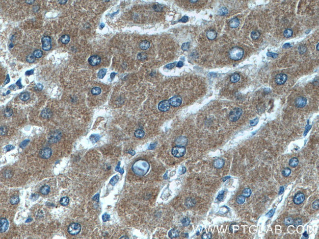 Choline kinase alpha Antibody in Immunohistochemistry (Paraffin) (IHC (P))