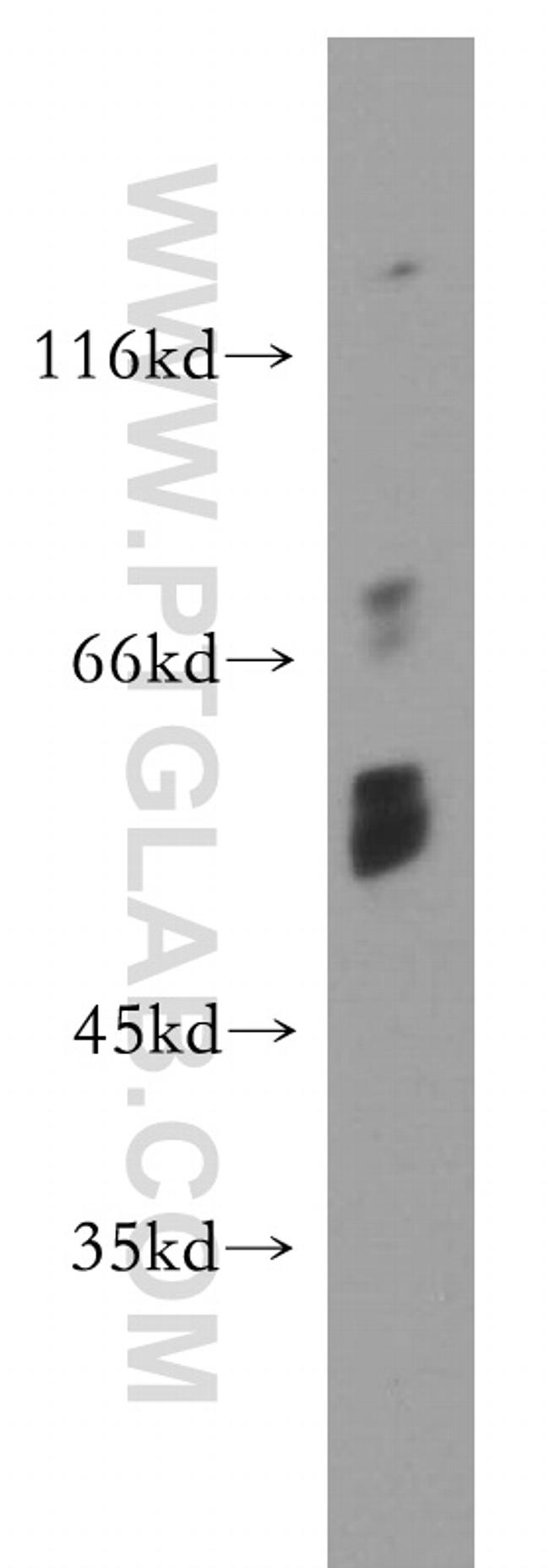 Choline kinase alpha Antibody in Western Blot (WB)