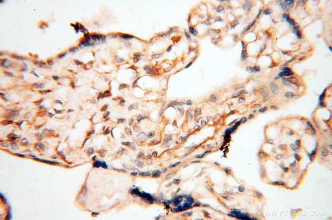 P2RX4 Antibody in Immunohistochemistry (Paraffin) (IHC (P))