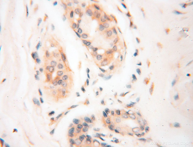 P2RX4 Antibody in Immunohistochemistry (Paraffin) (IHC (P))