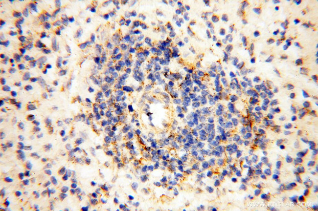 P2RX4 Antibody in Immunohistochemistry (Paraffin) (IHC (P))