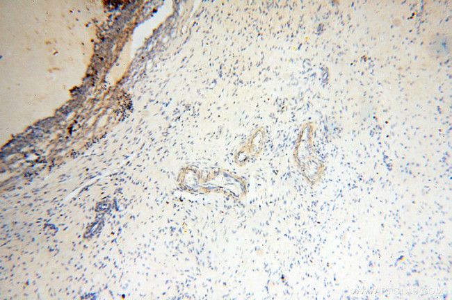 P2RX4 Antibody in Immunohistochemistry (Paraffin) (IHC (P))