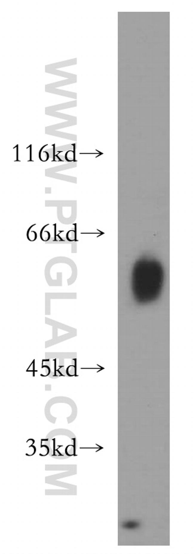 P2RX4 Antibody in Western Blot (WB)