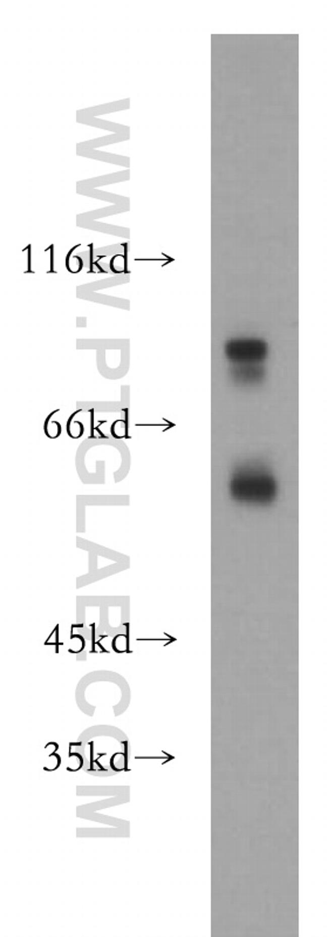 P2RX4 Antibody in Western Blot (WB)