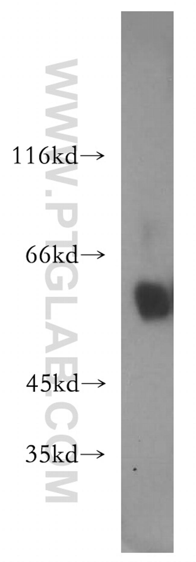 P2RX4 Antibody in Western Blot (WB)