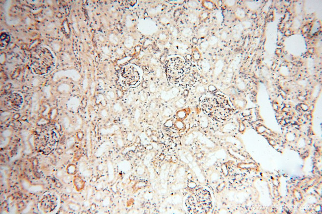 P2RX4 Antibody in Immunohistochemistry (Paraffin) (IHC (P))