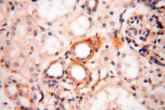 P2RX4 Antibody in Immunohistochemistry (Paraffin) (IHC (P))