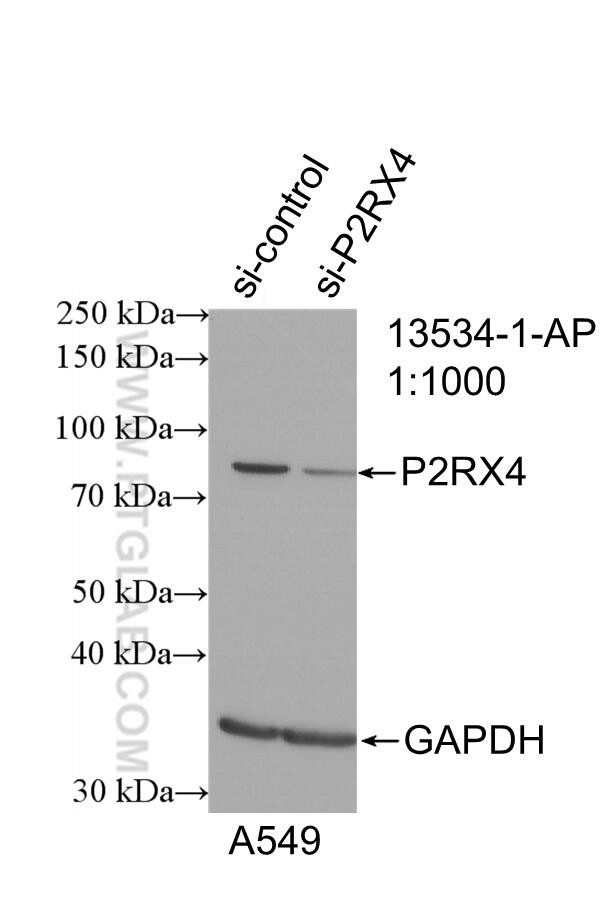 P2RX4 Antibody in Western Blot (WB)