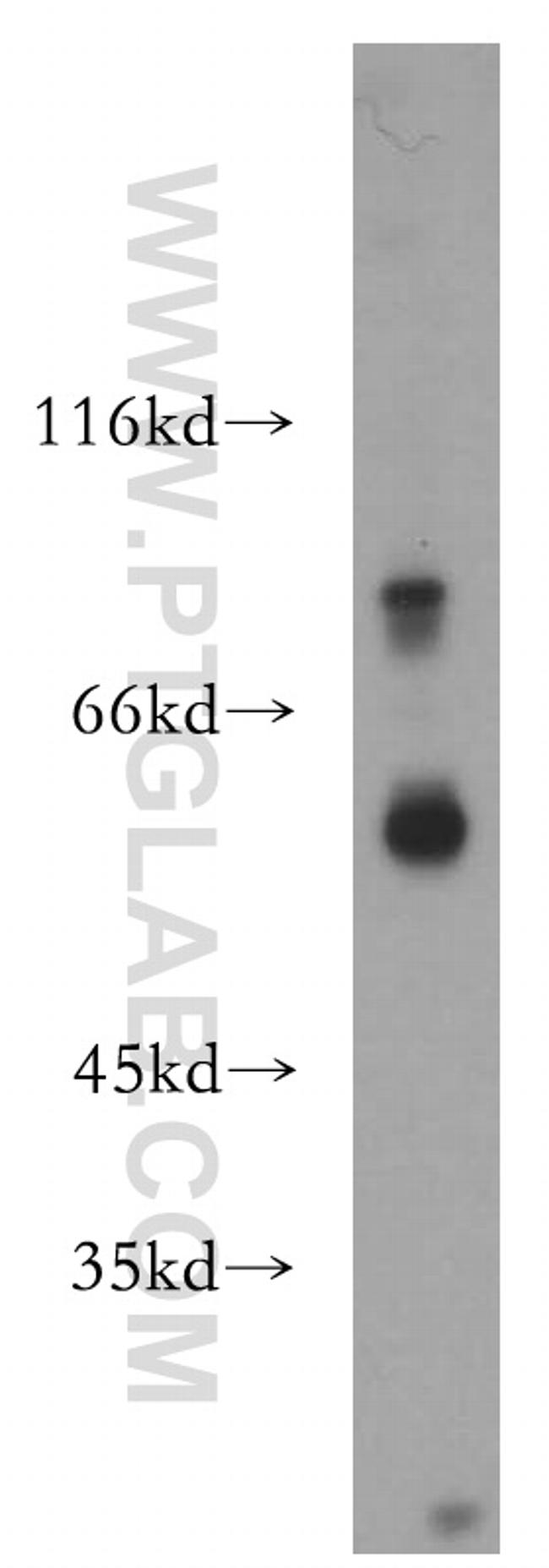 P2RX4 Antibody in Western Blot (WB)