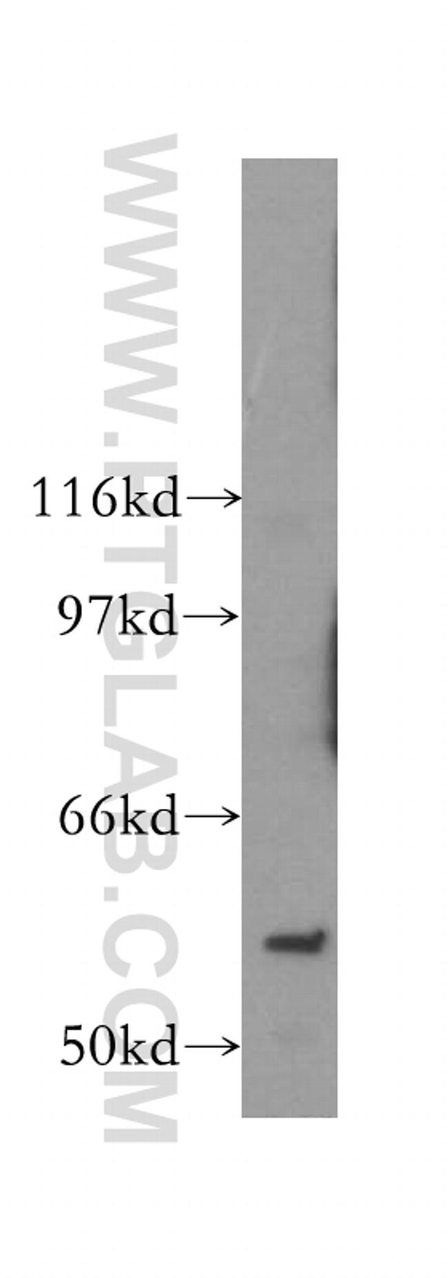 PAK6 Antibody in Western Blot (WB)