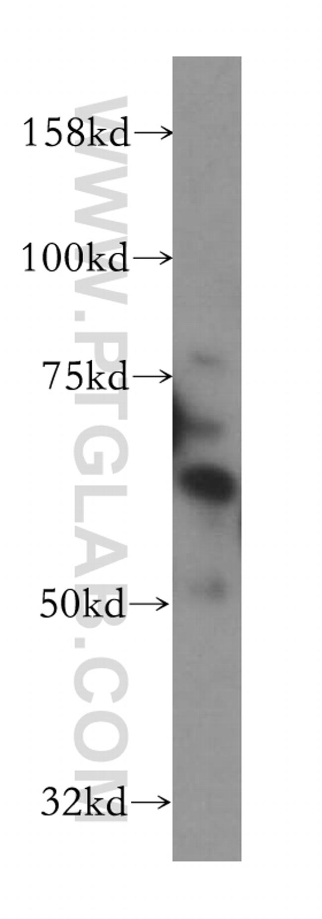 PAK6 Antibody in Western Blot (WB)