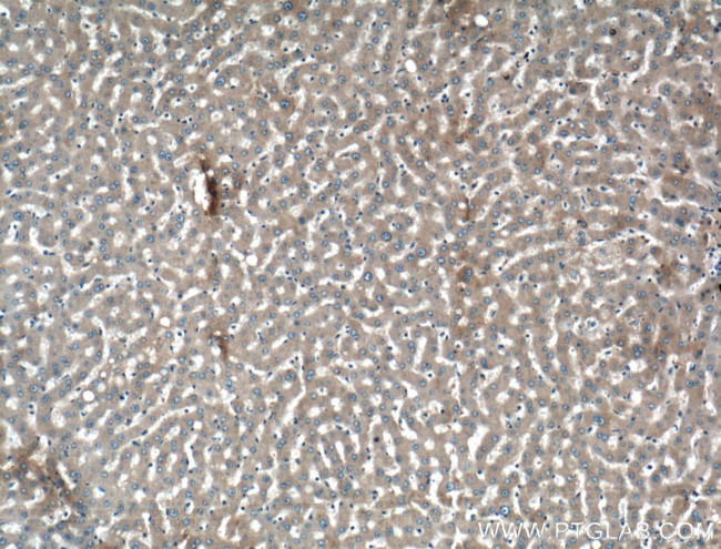 Alpha-2-macroglobulin Antibody in Immunohistochemistry (Paraffin) (IHC (P))