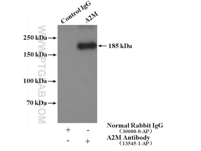 Alpha-2-macroglobulin Antibody in Immunoprecipitation (IP)