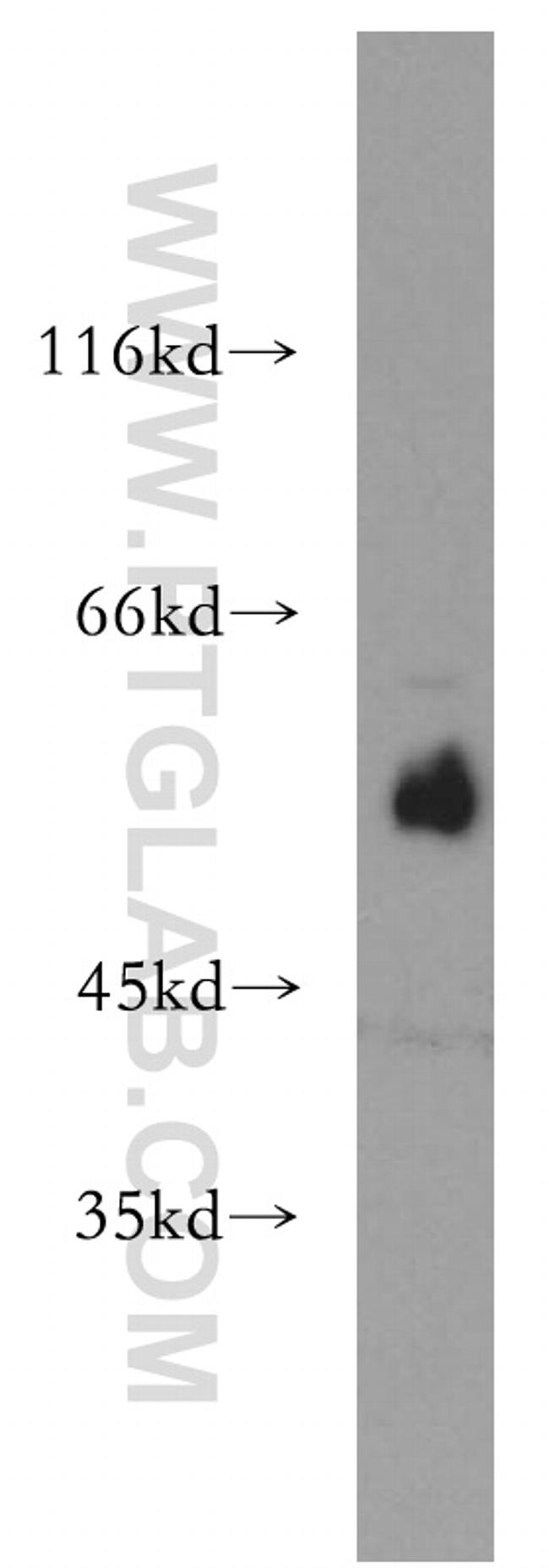 ST3GAL4 Antibody in Western Blot (WB)